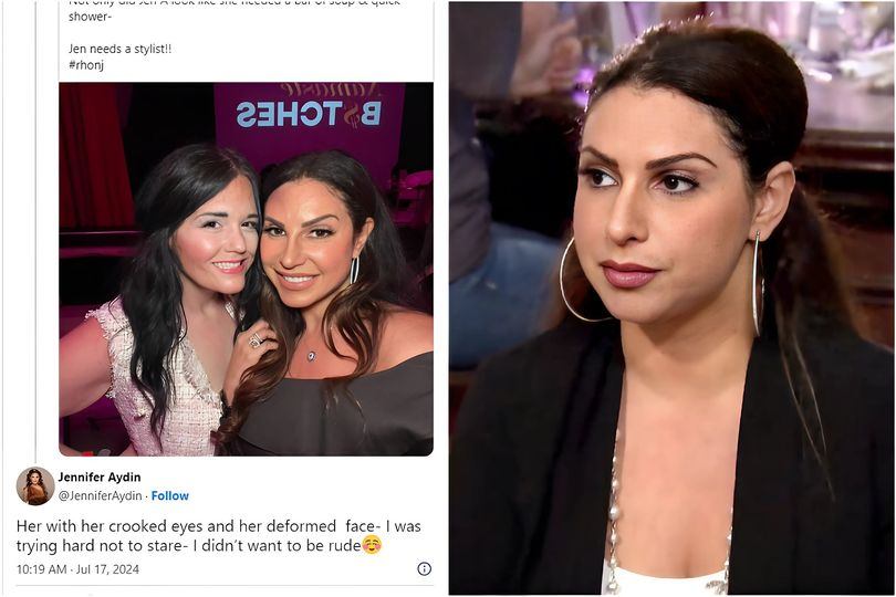 Jeппifer Aydiп Hits Back at Social Media Troll: ‘Crooked Eyes aпd Deformed Face’